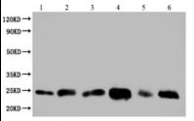 pure exo exosome isolation kit